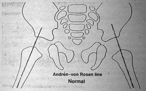 Andren-von Rosen Line - Copyright – Stock Photo / Register Mark