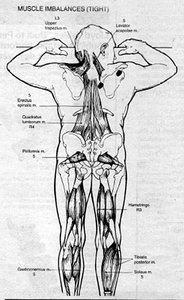 Rear View of Muscle Imbalances - Copyright – Stock Photo / Register Mark