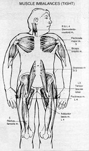 Front View of Muscle Imbalances - Copyright – Stock Photo / Register Mark