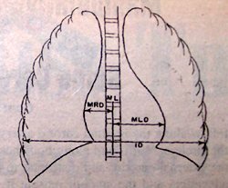 Spine and Lung Diagram - Copyright – Stock Photo / Register Mark