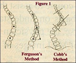 Ferguson vs. Cobb Methods - Copyright – Stock Photo / Register Mark