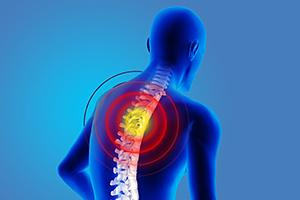 Thoracic Pain - Copyright – Stock Photo / Register Mark