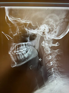 x-ray - Copyright – Stock Photo / Register Mark