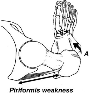 piriformis muscle - Copyright – Stock Photo / Register Mark