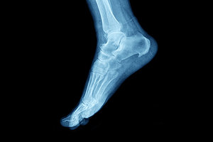 ankle - Copyright – Stock Photo / Register Mark