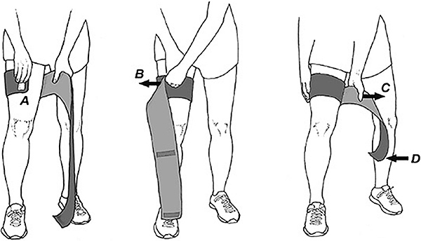 blood flow resistance - Copyright – Stock Photo / Register Mark