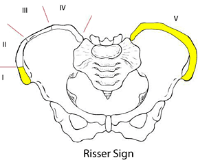 Cervical spine maturation - Copyright – Stock Photo / Register Mark