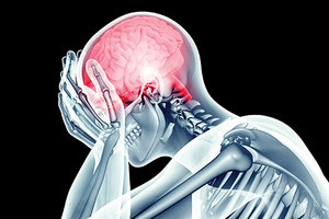 concussion - Copyright – Stock Photo / Register Mark