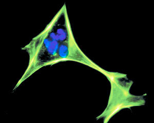 fibroblast cell - Copyright – Stock Photo / Register Mark