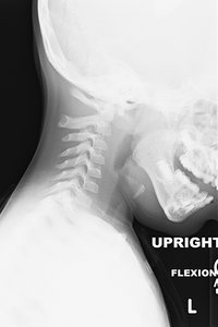 cervical flexion radiograph - Copyright – Stock Photo / Register Mark