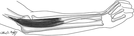 figure 2 - Copyright – Stock Photo / Register Mark