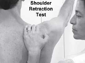 scapular retraction test - Copyright – Stock Photo / Register Mark