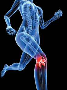 knee pain - Copyright – Stock Photo / Register Mark