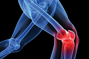 knee pain - Copyright – Stock Photo / Register Mark