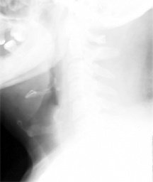 image - Copyright – Stock Photo / Register Mark