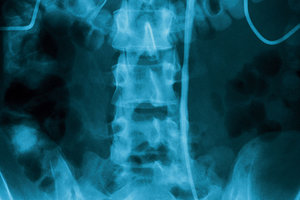 lumbar - Copyright – Stock Photo / Register Mark