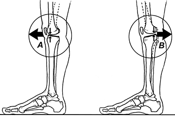 tibial plateau - Copyright – Stock Photo / Register Mark