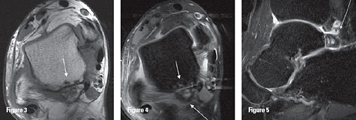 Axial PAIS T1, Axial PAIS T2 and Sagittal PAIS T2 - Copyright – Stock Photo / Register Mark