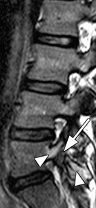 Magnetic resonance sagittal - Copyright – Stock Photo / Register Mark