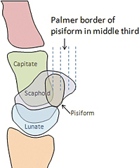 pisiform - Copyright – Stock Photo / Register Mark