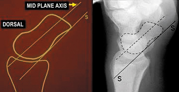 Axis of the scaphoid - Copyright – Stock Photo / Register Mark