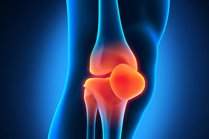 Patellofemoral Arthralgia - Copyright – Stock Photo / Register Mark