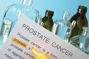 prostate cancer - Copyright – Stock Photo / Register Mark