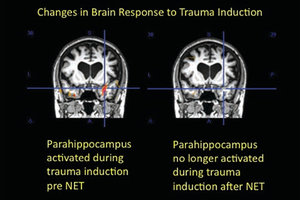 brain response - Copyright – Stock Photo / Register Mark