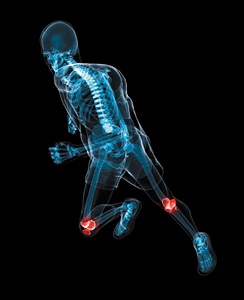 runner in pain - Copyright – Stock Photo / Register Mark