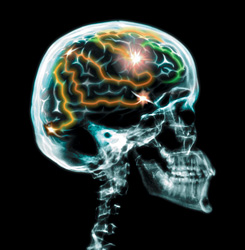 scull - Copyright – Stock Photo / Register Mark